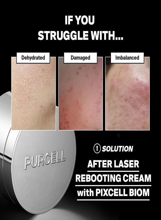 PURCELL PIXCELL BIOM™ After Laser Rebooting Cream for Probiotic Barrier Recovery with Niacinamide, Panthenol, Suitable for Sensitive Skin, 1.69 fl oz(50ml) - Image 2